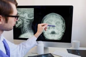 dentiste qui montre la relation entre une sinusite et un mal de dents